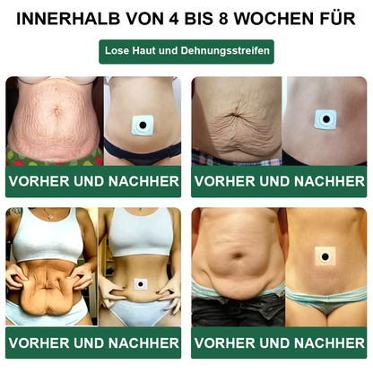 🌿🐝HYNAN™🌐🌐 Bienengift Wermut Detox Schlankheitspflaster【Empfohlen vom Arzt - Geeignet für Männer und Frauen】