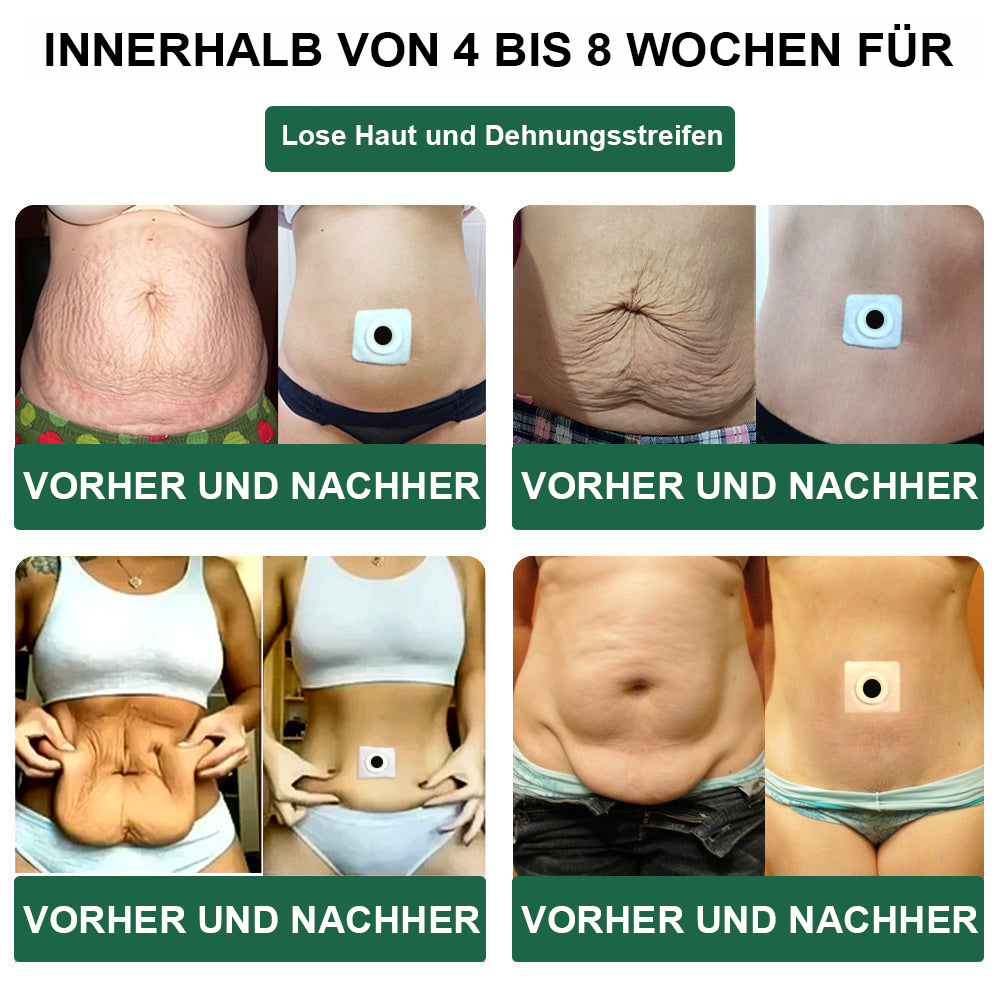 🌿🎁 Nur noch 5 Packungen übrig! Wir bieten Ihnen einen zusätzlichen Rabatt von 50% an! Wenn Sie diese Gelegenheit verpassen, müssen Sie ein weiteres Jahr warten.