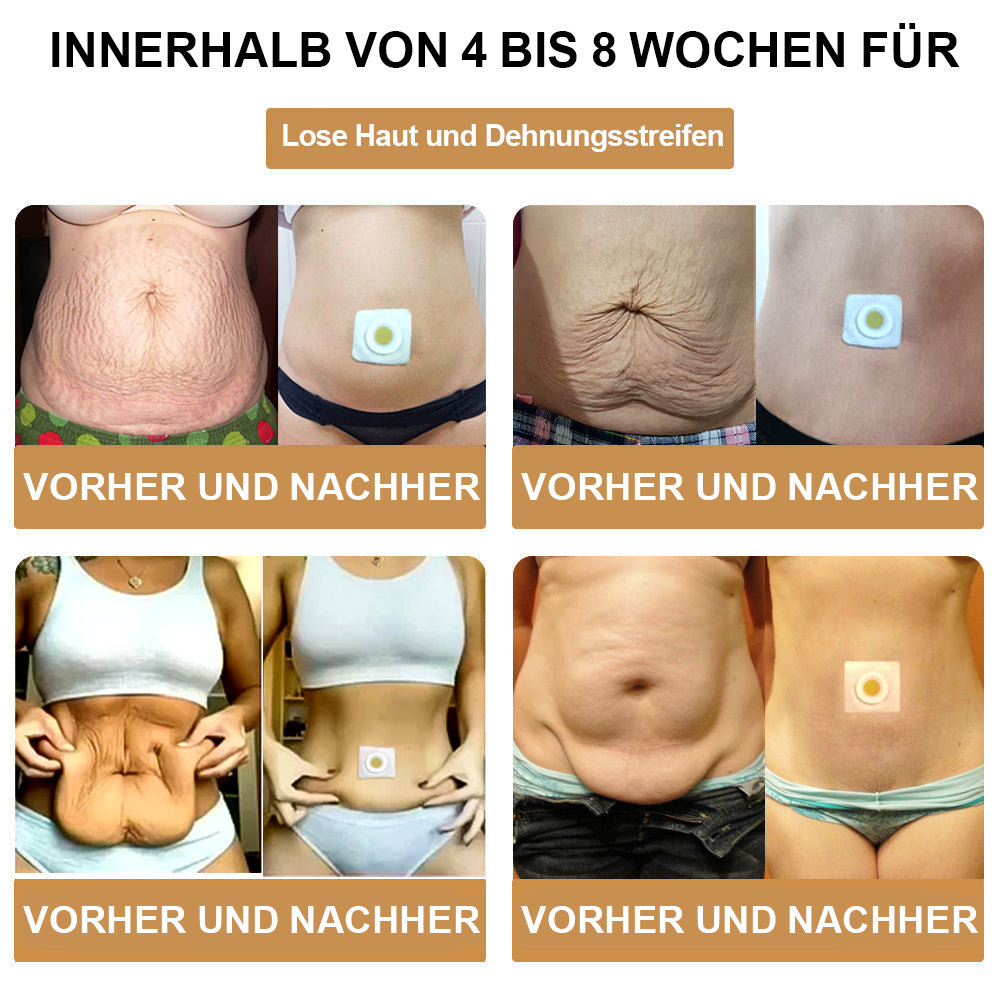 🏆🐝 AFGAFG™ Bienen-Venom Lymphatischer Drainage Schlank-Patch【Empfohlen vom Arzt - Geeignet für Männer und Frauen】