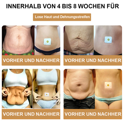 🌿🐝 AFGAFG™🌐🌐 Bienen-Venom Lymphatischer Drainage Schlank-Patch【Empfohlen vom Arzt - Geeignet für Männer und Frauen】