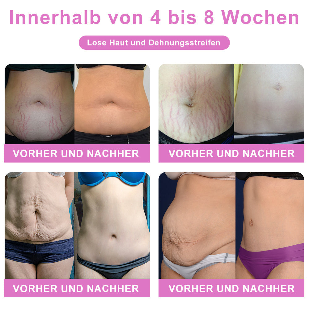 👑👑👑KaaLa™ Negative Ion Fettabbau, Bauchstraffung, entgiftende Formhose【Letzte 20 Minuten, begrenztes Angebot: 7 Rabatt】