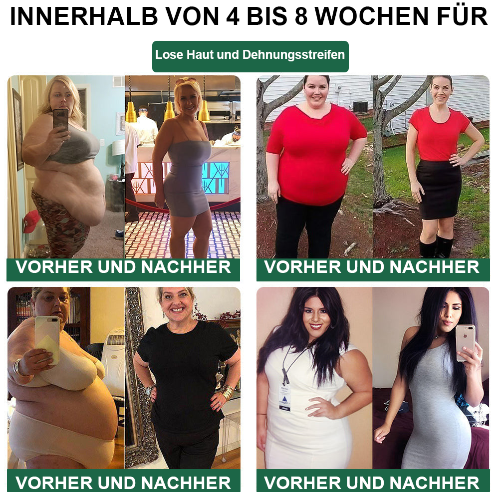 🌿🐝HYNAN™🌐🌐 Bienengift Wermut Detox Schlankheitspflaster【Empfohlen vom Arzt - Geeignet für Männer und Frauen】