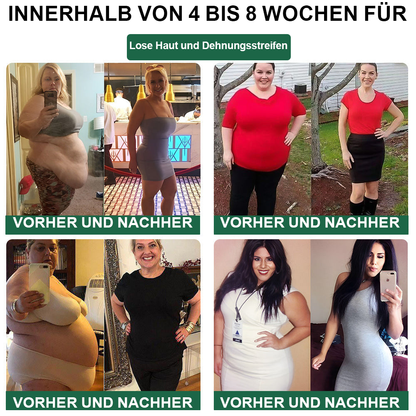 🌿🎁 Nur noch 5 Packungen übrig! Wir bieten Ihnen einen zusätzlichen Rabatt von 50% an! Wenn Sie diese Gelegenheit verpassen, müssen Sie ein weiteres Jahr warten.