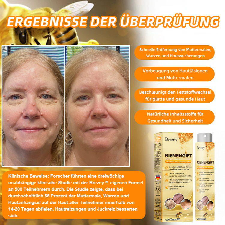 🍂🐝Brezey™ Bienengift Warze & Tag Entfernung Spray(👨‍⚕Für alle Hauttypen geeignet)🐝(🔥Aktion am letzten Tag 70% Rabatt)