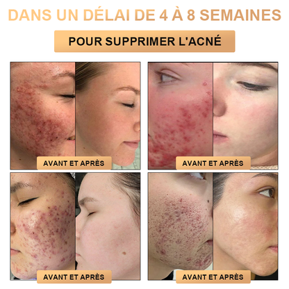 🔥PLTOWE™ Crème Super Anti-Âge🔥 Remise limitée aux 30 dernières minutes (Convient à tous les âges)