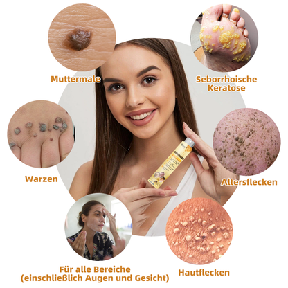 🍂🐝Brezey™ Bienengift Warze & Tag Entfernung Spray(👨‍⚕Für alle Hauttypen geeignet)🐝(🔥Aktion am letzten Tag 70% Rabatt)