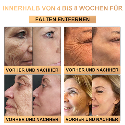 🐝🐝  PLTOWE™ Super Anti-Aging Creme🔥 Begrenzter Zeitrabatt Letzte 30 Minuten (Geeignet für alle Altersgruppen)