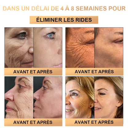 🔥PLTOWE™ Crème Super Anti-Âge🔥 Remise limitée aux 30 dernières minutes (Convient à tous les âges)