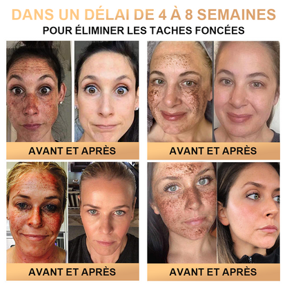 🔥PLTOWE™ Crème Super Anti-Âge🔥 Remise limitée aux 30 dernières minutes (Convient à tous les âges)