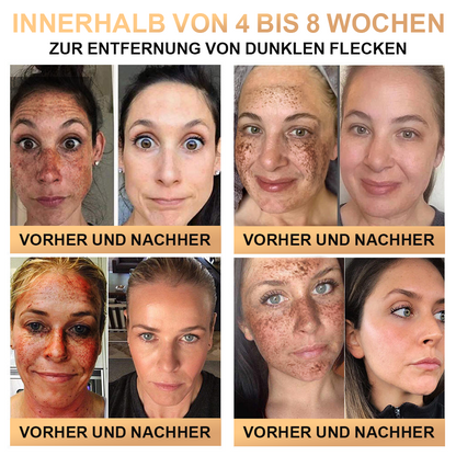 🐝🐝  PLTOWE™ Super Anti-Aging Creme🔥 Begrenzter Zeitrabatt Letzte 30 Minuten (Geeignet für alle Altersgruppen)