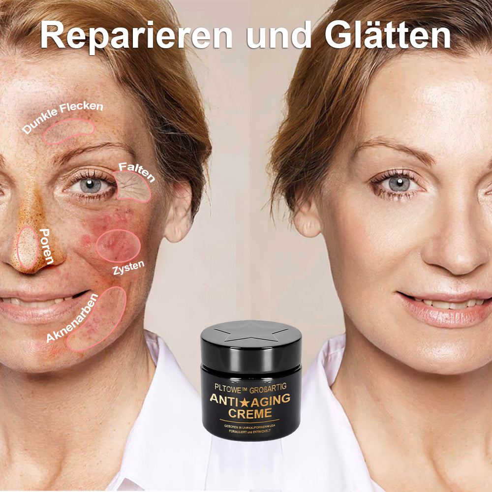 🐝🐝  PLTOWE™ Super Anti-Aging Creme🔥 Begrenzter Zeitrabatt Letzte 30 Minuten (Geeignet für alle Altersgruppen)